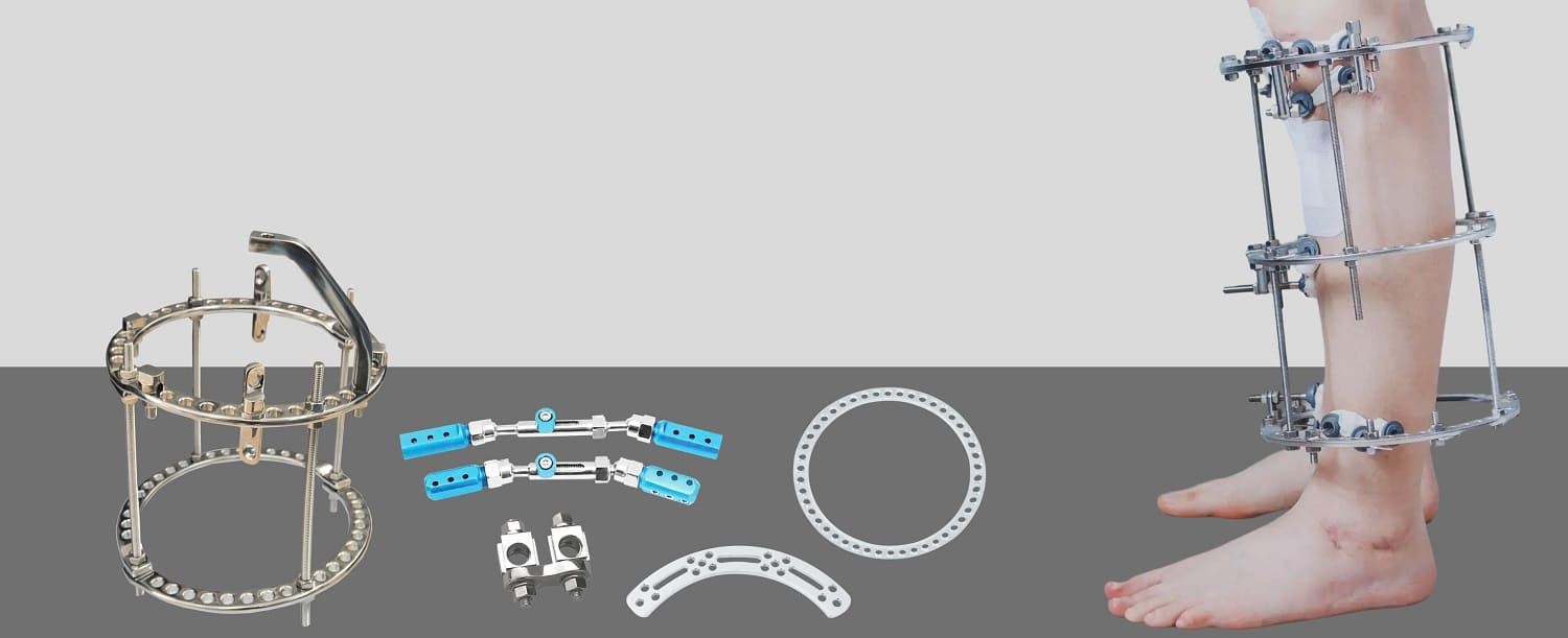 External Fixator